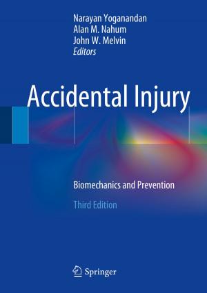 Cover of the book Accidental Injury by Michael S. Hand, Krista M. Gebert, Jingjing Liang, David E. Calkin, Matthew P. Thompson, Mo Zhou