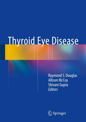 Cover of the book Thyroid Eye Disease by Nicola Bellomo, Giulia Ajmone Marsan, Andrea Tosin