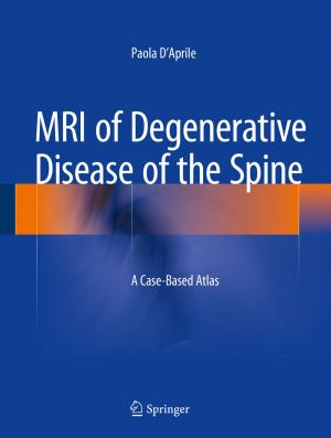 Cover of the book MRI of Degenerative Disease of the Spine by Andrea Iacona