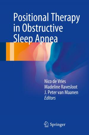 Cover of the book Positional Therapy in Obstructive Sleep Apnea by Harald Friedrich