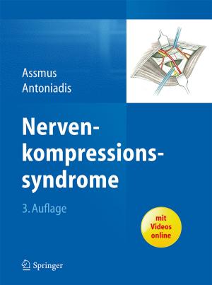 Cover of the book Nervenkompressionssyndrome by Wolfgang Schrepp, Harald Pasch