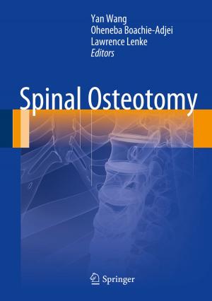 Cover of the book Spinal Osteotomy by Yontcho Pelovski, Stoyan K. Stoyanov