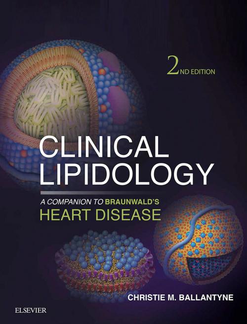 Cover of the book Clinical Lipidology: A Companion to Braunwald's Heart Disease E-Book by Christie M. Ballantyne, MD, Elsevier Health Sciences