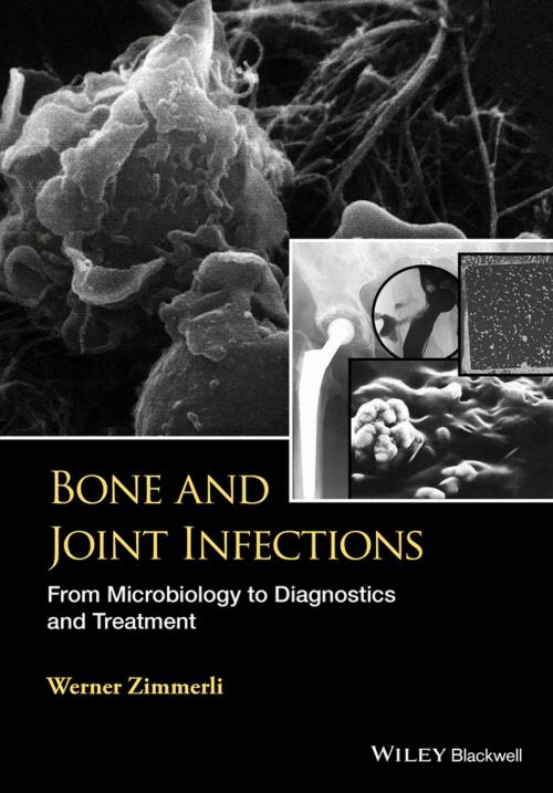 Cover of the book Bone and Joint Infections by W. Zimmerli, Wiley