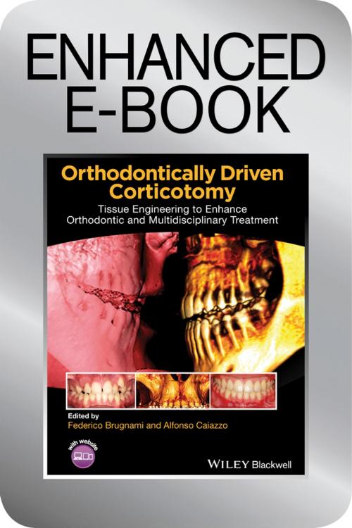 Cover of the book Orthodontically Driven Corticotomy by , Wiley