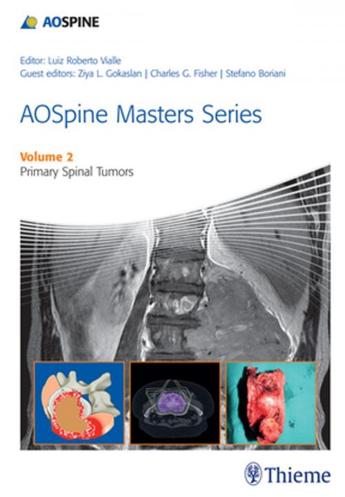 Cover of the book AOSpine Masters Series Volume 2: Primary Spinal Tumors by Luiz Roberto Gomes Vialle, Ziya L. Gokaslan, Stefano Boriani, Thieme