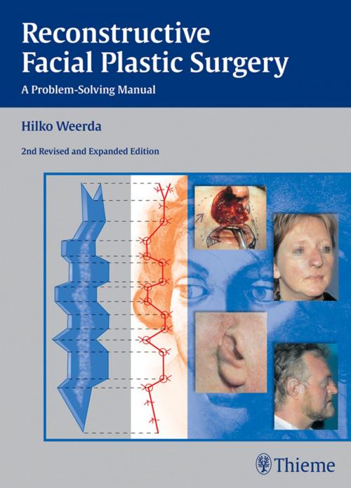 Cover of the book Reconstructive Facial Plastic Surgery by Hilko Weerda, Thieme