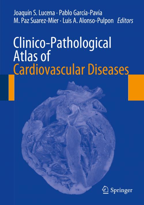 Cover of the book Clinico-Pathological Atlas of Cardiovascular Diseases by , Springer International Publishing