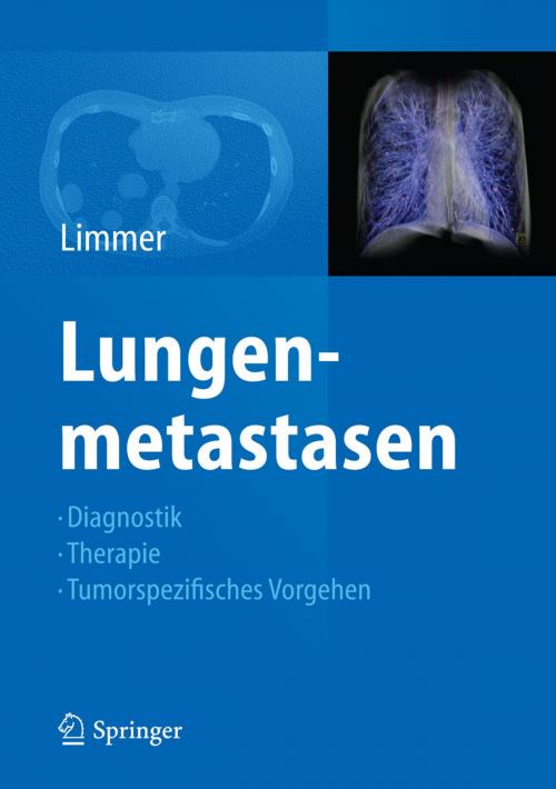 Cover of the book Lungenmetastasen by , Springer Berlin Heidelberg