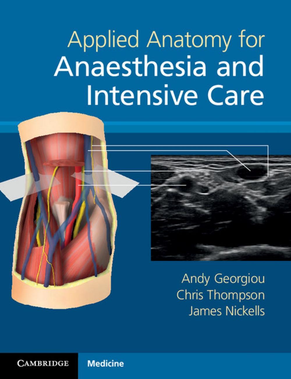 Big bigCover of Applied Anatomy for Anaesthesia and Intensive Care
