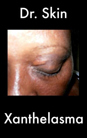 Cover of the book Xanthelasma by Dr Skin