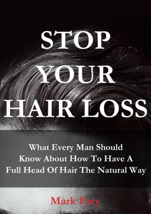 Cover of the book Stop Your Hair Loss: What Every Man Should Know About How To Have A Full Head Of Hair The Natural Way by Chandran K C
