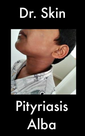 Cover of the book Pityriasis Alba by Dr Skin