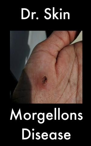 bigCover of the book Morgellons Disease by 
