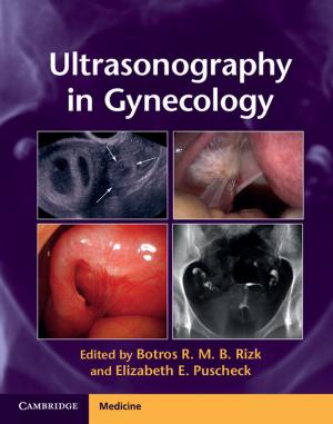 Cover of the book Ultrasonography in Gynecology by 