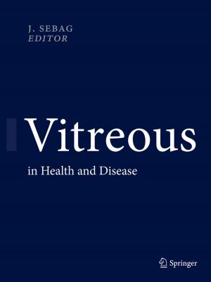 Cover of the book Vitreous by Jyoti Belur