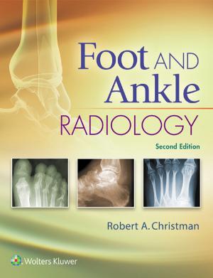 Cover of the book Foot and Ankle Radiology by Javier López León, Francisco Poveda Blanco, Sonia Castedo Ramos, Fernando Plaza González