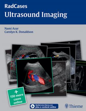 Cover of the book Ultrasound Imaging by Walter Kemp, Travis Brown