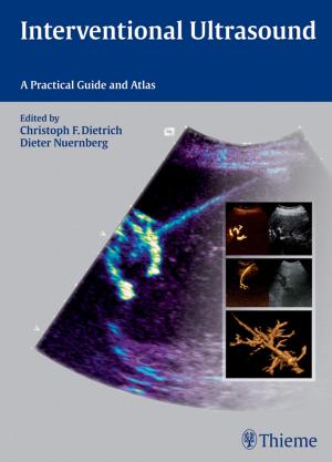 Book cover of Interventional Ultrasound