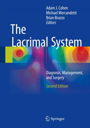 Cover of the book The Lacrimal System by Mikhail V. Solodov, Alexey F. Izmailov