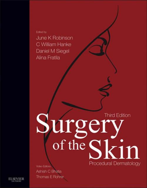 Cover of the book Surgery of the Skin E-Book by June K. Robinson, MD, C. William Hanke, MD, MPH, FACP, Daniel Mark Siegel, MD, MS(Management and Policy), Alina Fratila, MD, Ashish C Bhatia, MD, FAAD, Thomas E. Rohrer, MD, Elsevier Health Sciences
