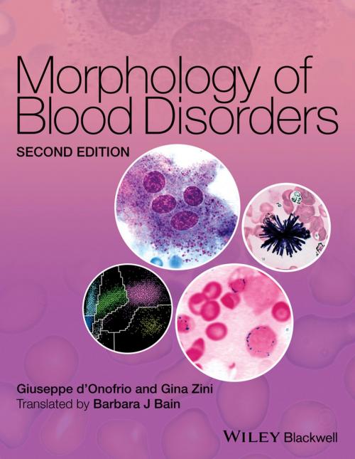 Cover of the book Morphology of Blood Disorders by Giuseppe d'Onofrio, Gina Zini, Wiley