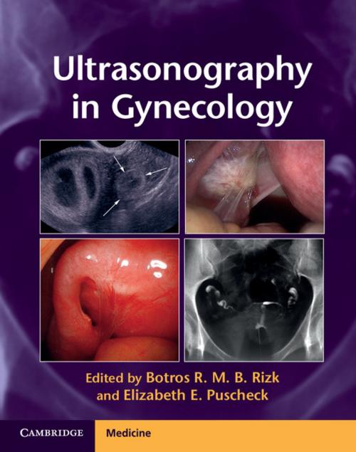 Cover of the book Ultrasonography in Gynecology by , Cambridge University Press