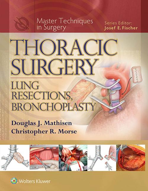 Cover of the book Thoracic Surgery: Lung Resections, Bronchoplasty by Douglas J. Mathisen, Christopher Morse, Wolters Kluwer Health