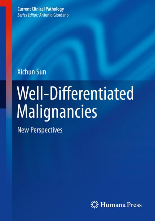 Cover of the book Well-Differentiated Malignancies by Xichun Sun, Springer New York