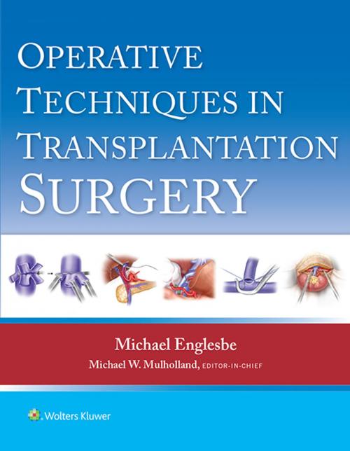 Cover of the book Operative Techniques in Transplantation Surgery by Michael J. Englesbe, Michael W. Mulholland, Wolters Kluwer Health