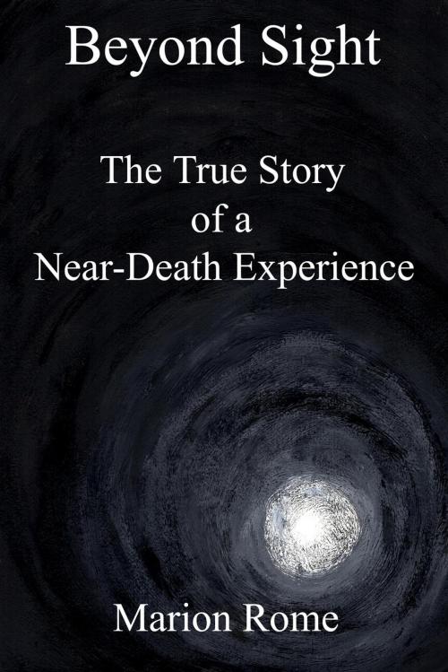 Cover of the book Beyond Sight: The True Story of a Near-Death Experience by Marion Rome, Self-Published