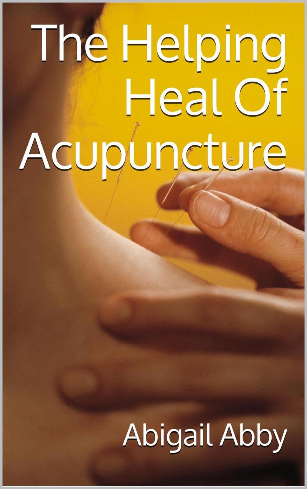 Big bigCover of The Helping Heal Of Acupuncture