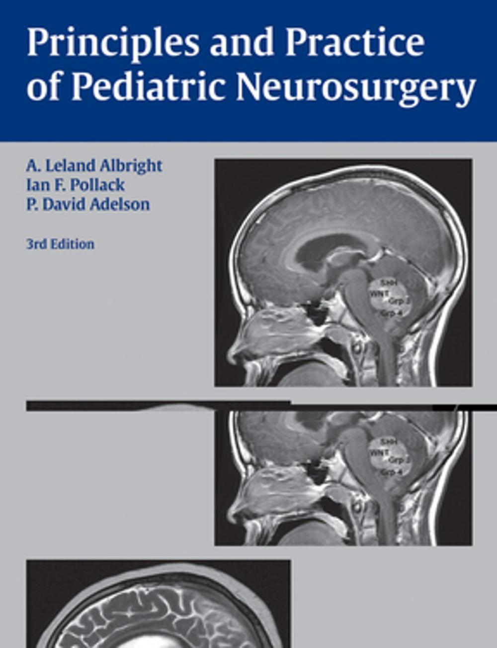 Big bigCover of Principles and Practice of Pediatric Neurosurgery