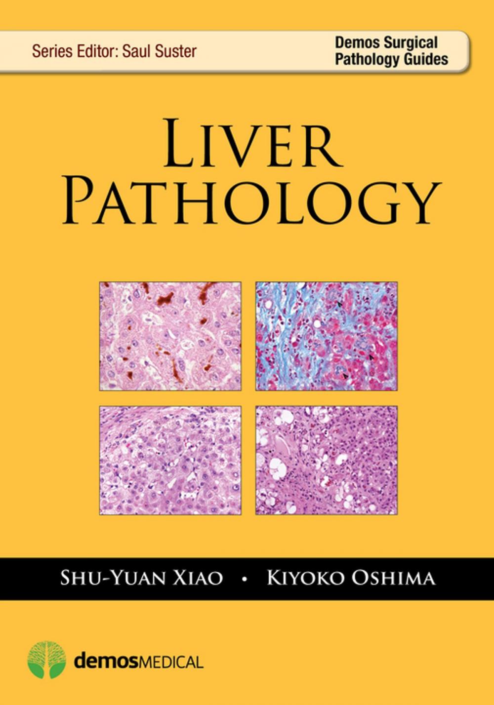 Big bigCover of Liver Pathology