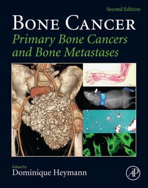 Book cover of Bone Cancer
