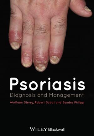 Cover of the book Psoriasis by Nicholas S. Williams