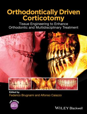 Cover of the book Orthodontically Driven Corticotomy by Philip Rowe