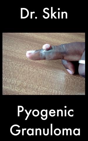 Cover of the book Pyogenic Granuloma by Dr Skin
