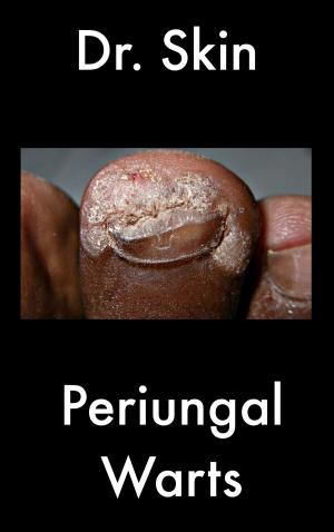 Cover of the book Periungal Warts by Dr Skin