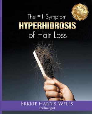 Cover of The #1 Symptom of Hair Loss Hyperhidrosis