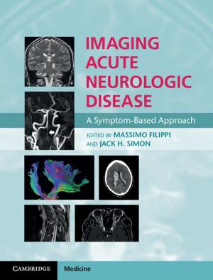 Cover of the book Imaging Acute Neurologic Disease by James D. Morrow