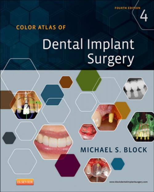 Cover of the book Color Atlas of Dental Implant Surgery - E-Book by Michael S. Block, DMD, Elsevier Health Sciences
