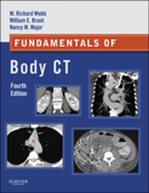 Cover of the book Fundamentals of Body CT E-Book by Nancy M. Major, MD, W. Richard Webb, MD, Wiliam E. Brant, MD, FACR, Elsevier Health Sciences