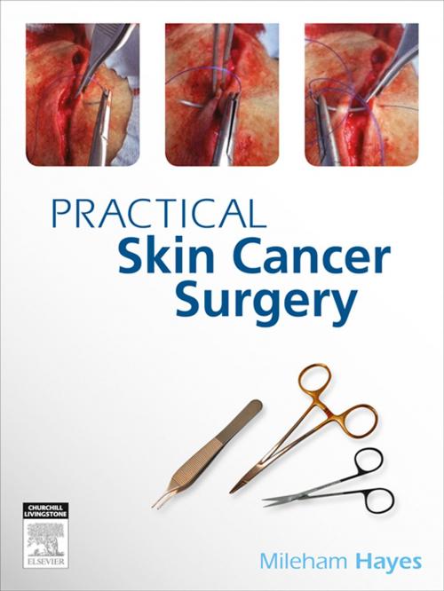 Cover of the book Practical Skin Cancer Surgery by MILEHAM HAYES, Elsevier Health Sciences
