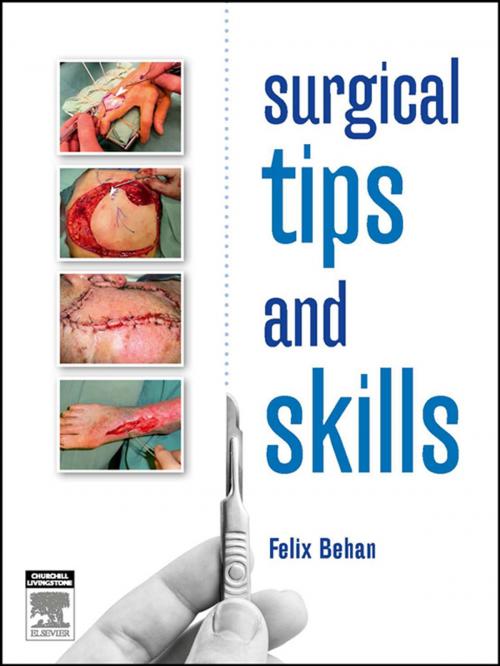 Cover of the book Surgical tips and skills - eBook by Felix Behan, FRCS FRACS, Elsevier Health Sciences