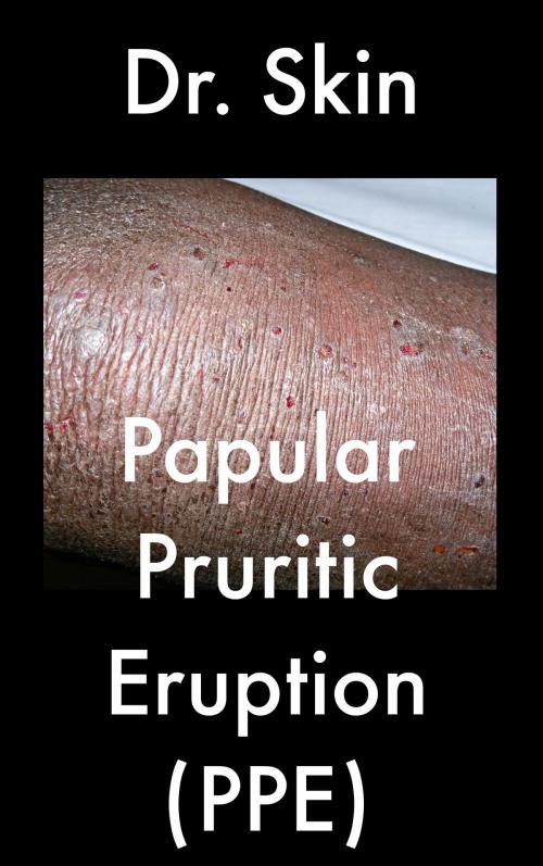 Cover of the book Papular Pruritic Eruption by Dr Skin, Dr Skin