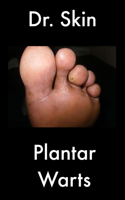 Cover of the book Plantar Warts by Dr Skin, Dr Skin