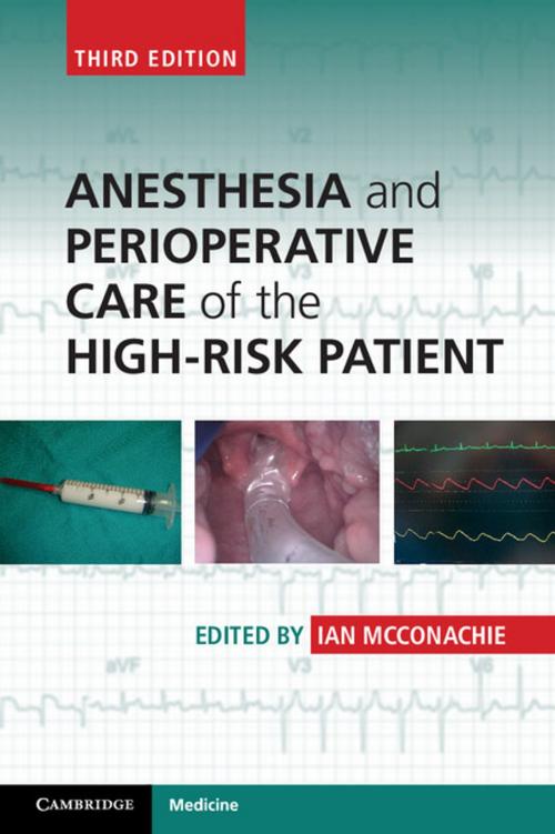 Cover of the book Anesthesia and Perioperative Care of the High-Risk Patient by , Cambridge University Press