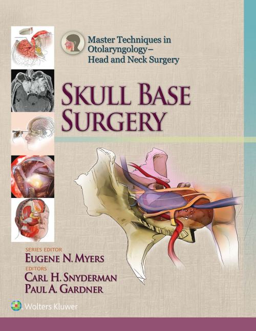 Cover of the book Master Techniques in Otolaryngology - Head and Neck Surgery: Skull Base Surgery by Carl Snyderman, Paul Gardner, Wolters Kluwer Health