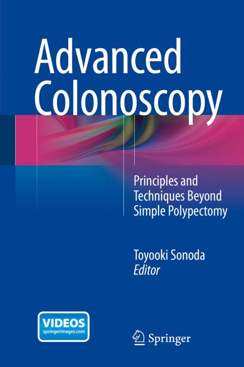 Cover of the book Advanced Colonoscopy by , Springer New York